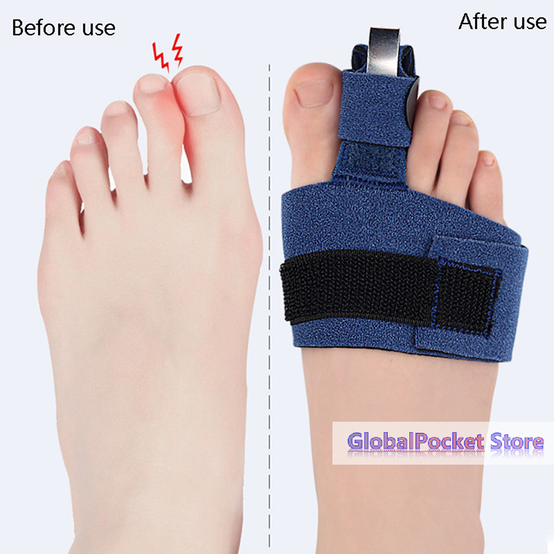 1Pcs Toe Corrector Toe Fractur – Ankle Brace Sock Bewertung und Preis